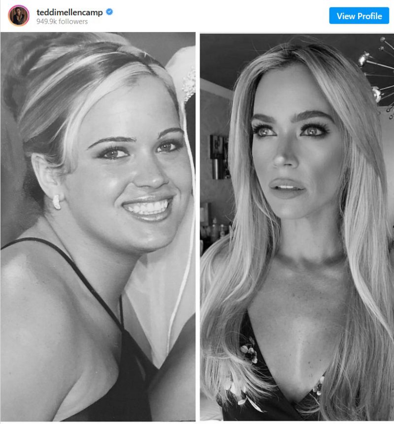 real-housewives-star-teddi-mellencamp-accused-of-fraud-with-diet